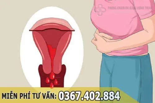Cách Rút Ngắn Ngày Đèn Đỏ