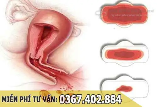 Cách Rút Ngắn Ngày Đèn Đỏ