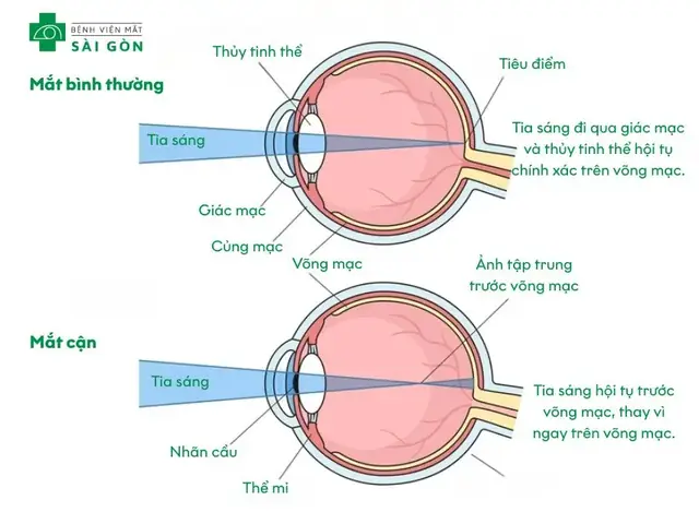Cách Tính Đèn Sáng Bình Thường