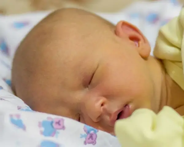 Chiếu Đèn Vẫn Bị Vàng Da