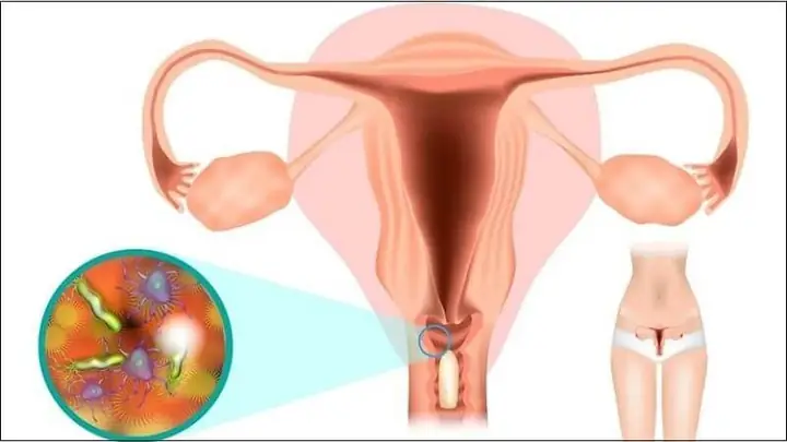 Quan Hệ Ngày Đèn Đỏ Bị Đau Rát