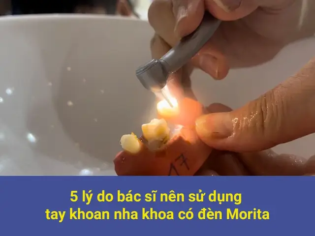 Tay Khoan Nha Khoa Có Đèn