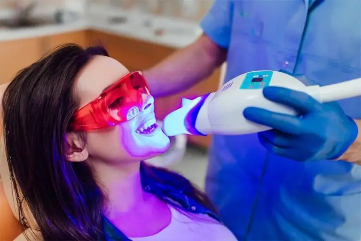 Tẩy Trắng Răng Bằng Đèn Laser