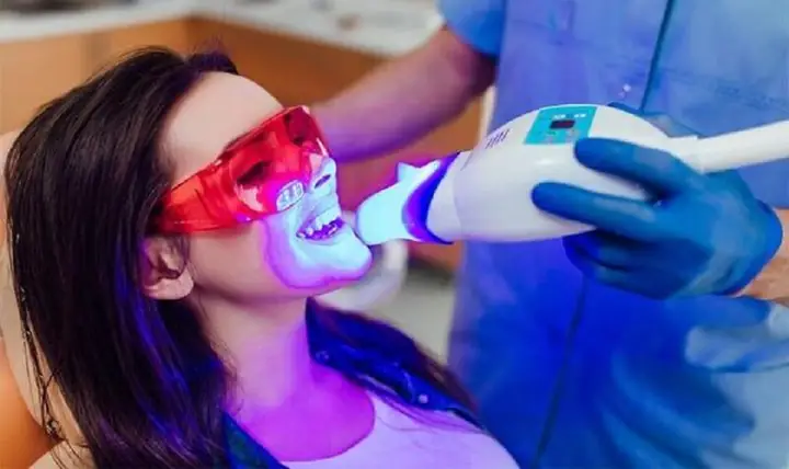 Tẩy Trắng Răng Bằng Đèn Laser