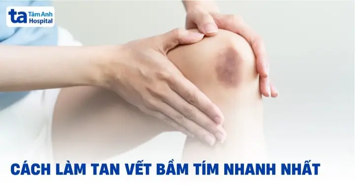 Cách Làm Tim Đèn Dầu