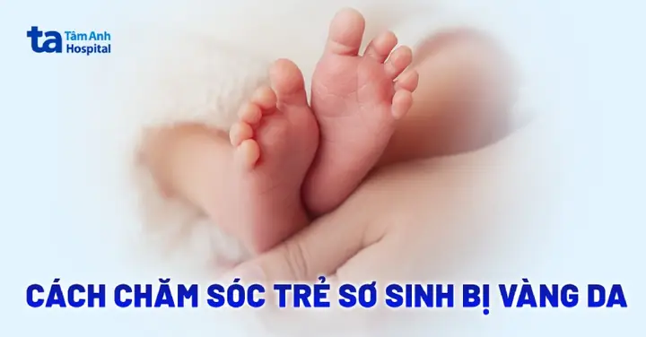 Chăm Sóc Trẻ Sơ Sinh Chiếu Đèn Vàng Da Chăm Sóc Trẻ Sơ Sinh Chiếu Đèn Vàng Da