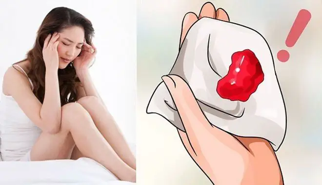 Đến Ngày Đèn Đỏ Nhưng Không Ra Máu
