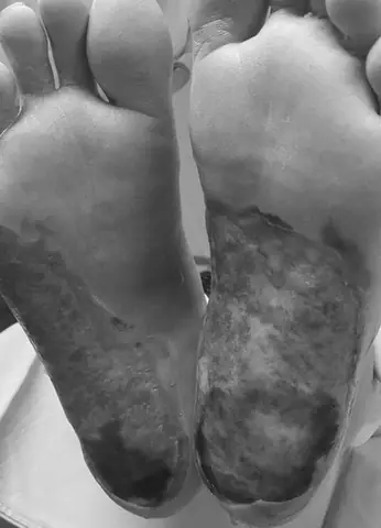 Đèn Sưởi Đá Muối Himalaya