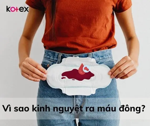 Ngày Đèn Đỏ Ra Nhiều Máu Cục