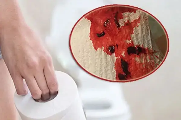 Ngày Đèn Đỏ Ra Nhiều Máu Cục