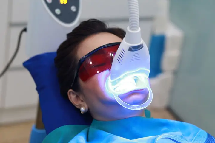 Tẩy Răng Bằng Đèn Plasma