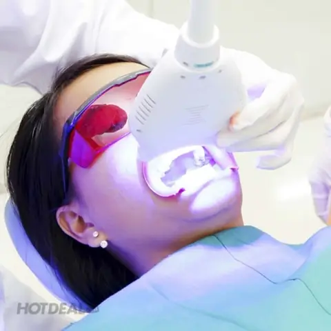 Tẩy Trắng Răng Bằng Đèn