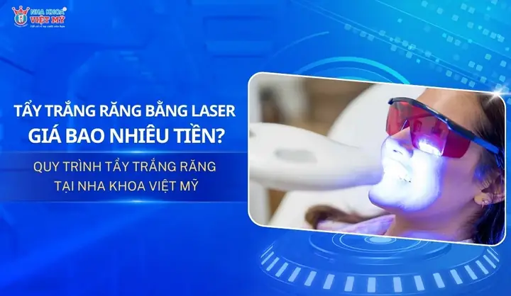 Tẩy Trắng Răng Bằng Đèn Plasma Bao Nhiêu Tiền