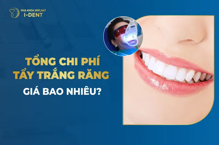 Tẩy Trắng Răng Bằng Đèn Plasma Bao Nhiêu Tiền